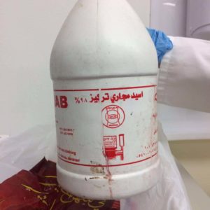 تسليك المجاري بالاسيد تسليك المجاري بالاسيد